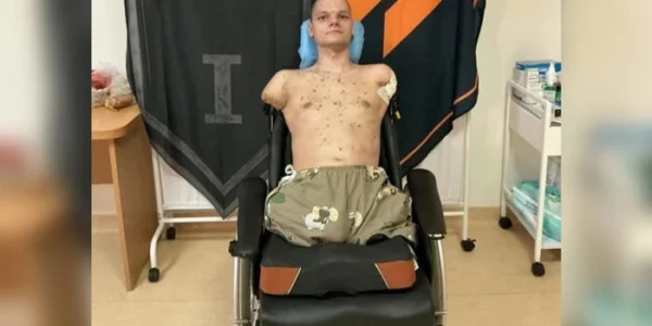 Приватбанк відмовився видати картку військовому з ампутаціями: деталі скандалу