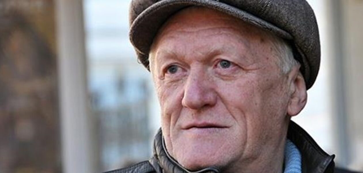 Відомий продюсер розповів про невдалі косметологічні процедури