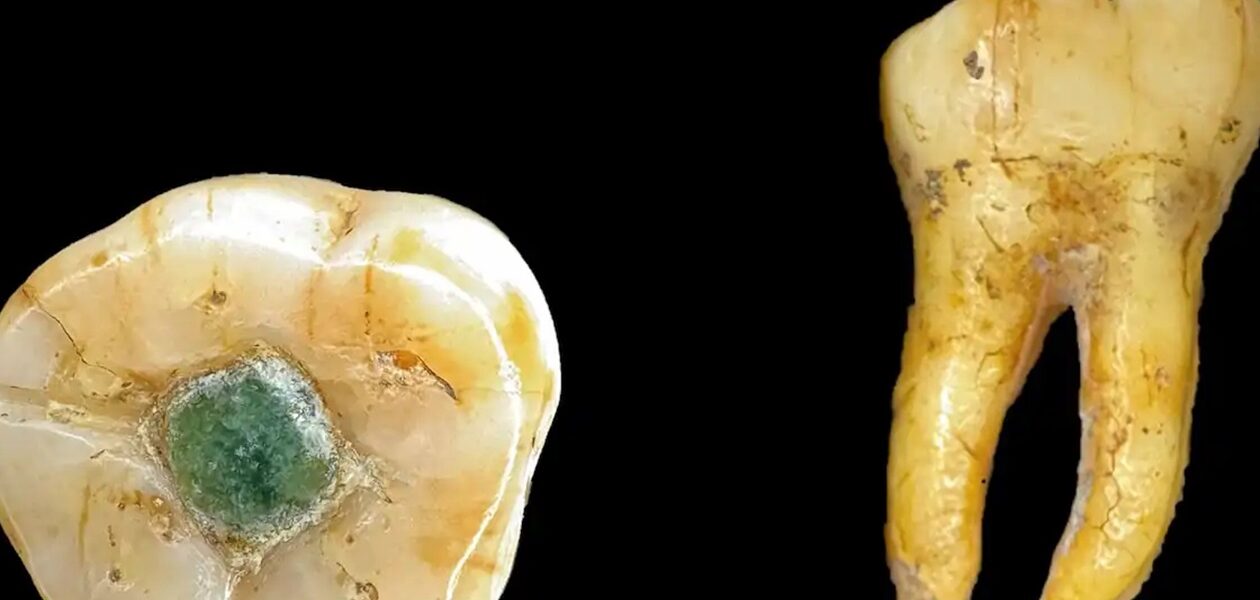 Давні мая використовували дорогоцінні камені як пломби