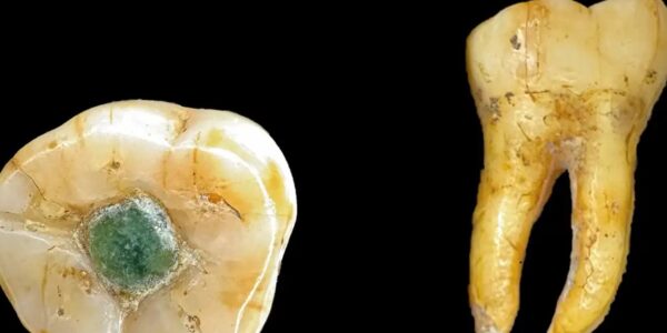 Давні мая використовували дорогоцінні камені як пломби